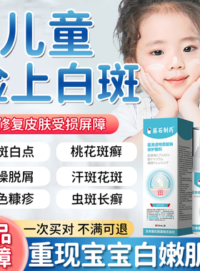 白色糠疹儿童脸部脸上长白斑维生素e乳膏汗斑桃花癣药房同款膏YZ