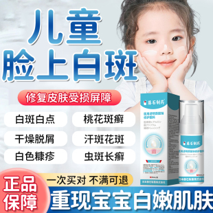 白色糠疹儿童脸部脸上长白斑维生素e乳膏汗斑桃花癣药房同款膏YZ