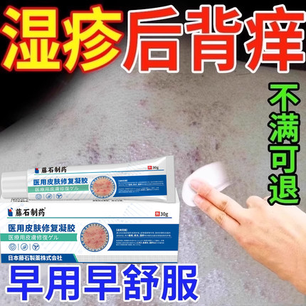 后背皮肤湿疹止痒去顽固皮炎根背部背后真菌感染专用除湿膏WQ