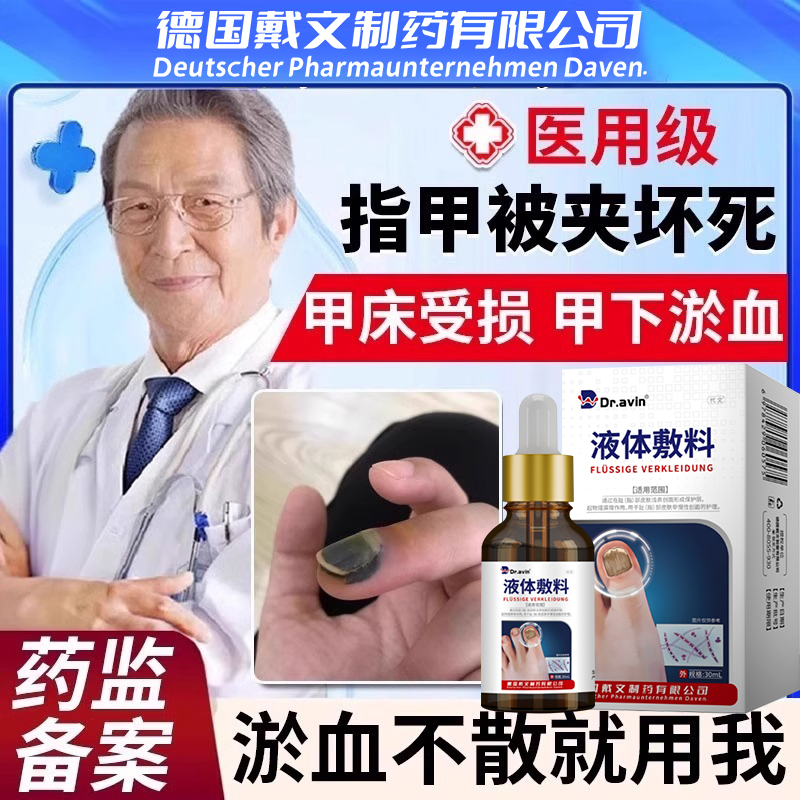 手脚趾指甲被夹被砸淤血淤青