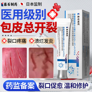 包皮裂口子开裂系带撕裂包皮炎龟头炎特专用效真菌感染药房同款YZ