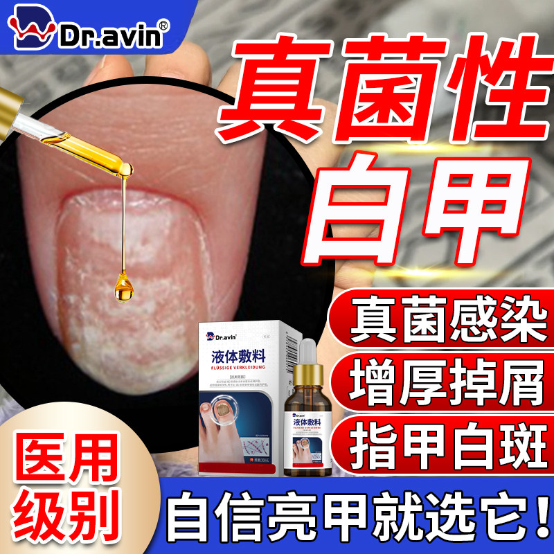 真菌性白甲银屑病指甲真菌感染脚趾甲增厚变黄甲癣专用药房同售VQ