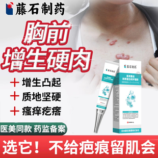 去胸前疤痕增生凸起硬肉去除疙瘩止痒软化针乳膏瘢痕除疤膏YZ