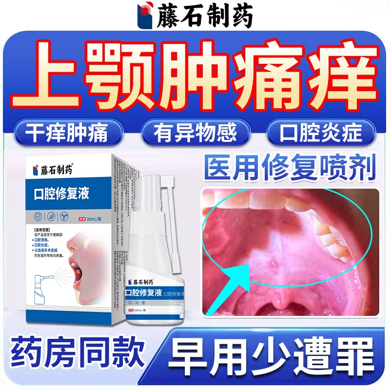 上颚痒肿痛发炎口腔黏膜炎症修复喷剂上壁水肿烫伤溃疡药房同款TU