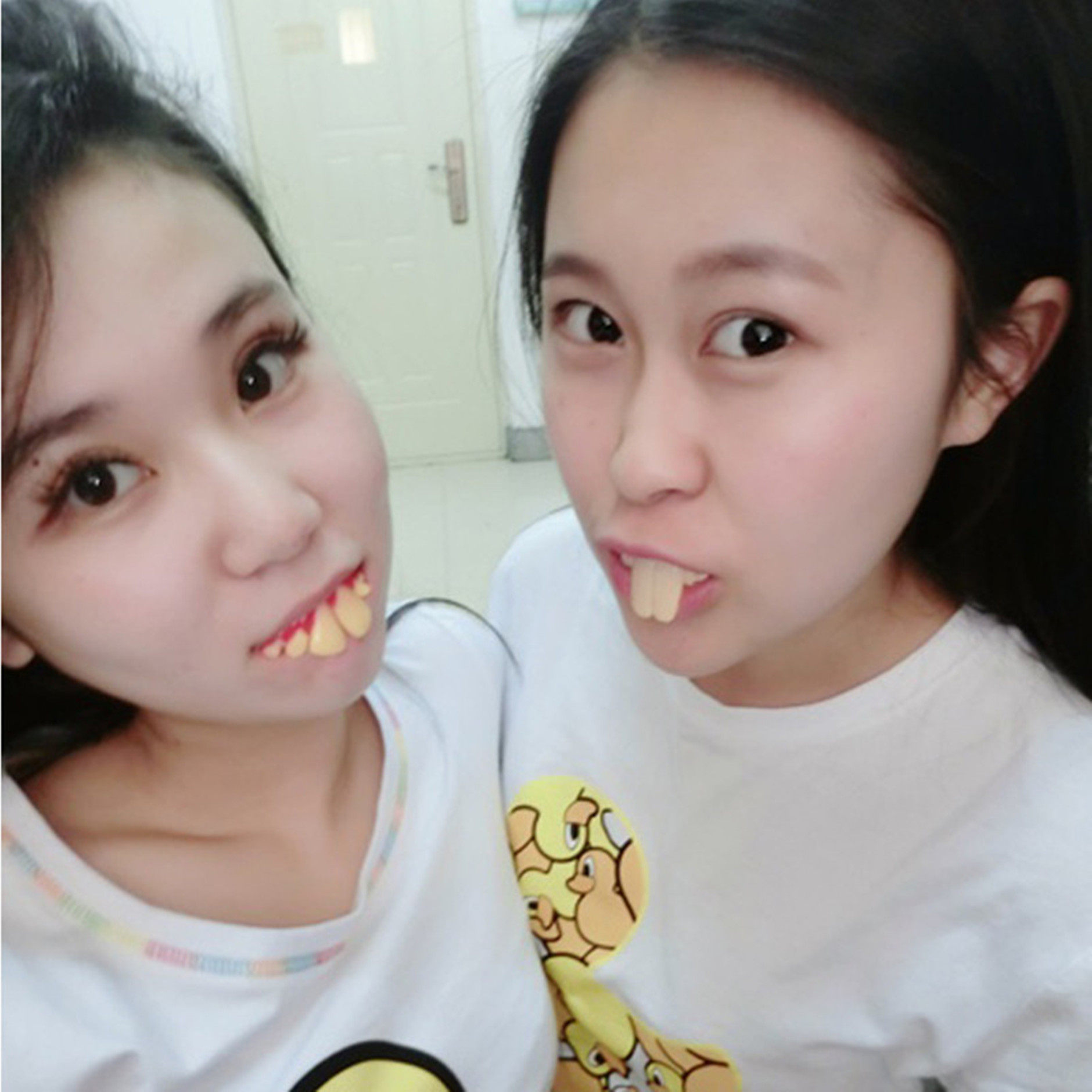 整蛊仿真牙套直播短视频恶搞笑龅牙假牙套愚人节网红搞怪牙齿道具