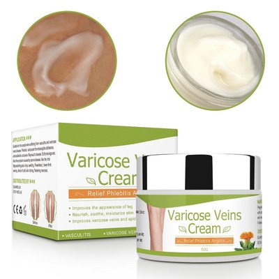 Varicose Veins Cream Natural Treatment Cream For Varicose an