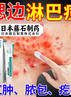 淋巴痘腮边痘专用下巴反复长痘脸上下颚长痤疮痘痘祛痘可搭膏药AZ