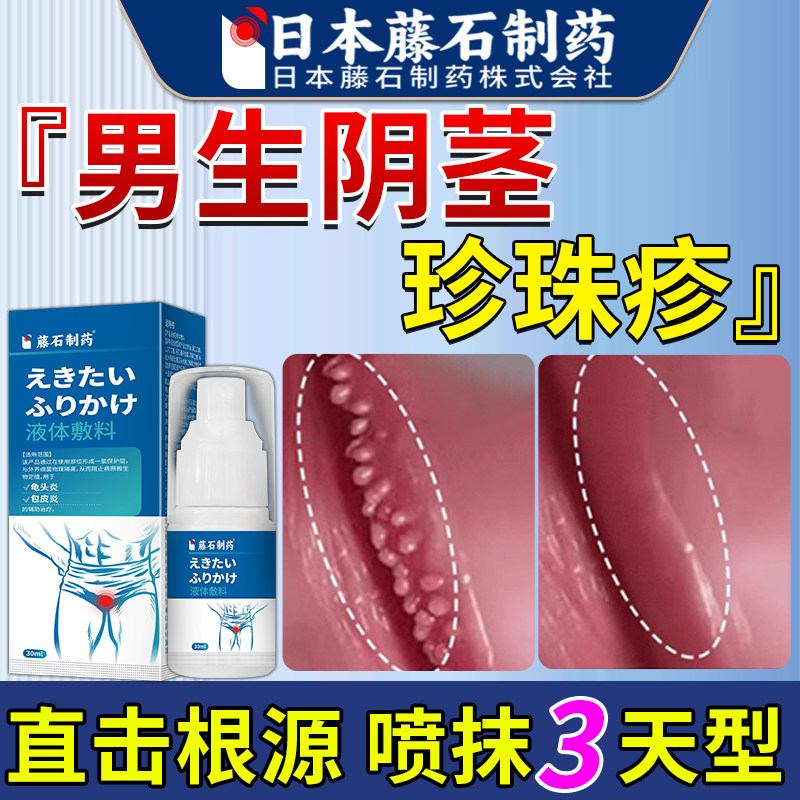 龟头下面肉粒阴茎珍珠丘疹去冠状沟阴茎粒皮疙瘩除药监备案AZ