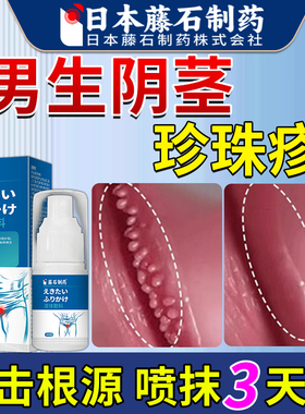 龟头下面肉粒阴茎珍珠丘疹去冠状沟阴茎粒皮疙瘩除药监备案AZ