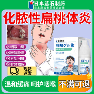 急性化脓性扁桃体炎喷雾剂喉咙肿痛扁桃体炎用的嗓子疼红肿SC