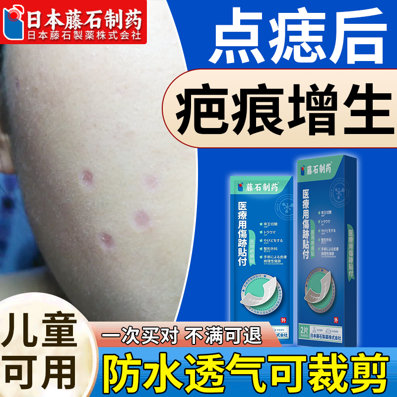 日本藤石点痣后疤痕修复贴