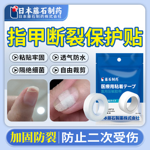 指甲劈了断裂手指甲盖开裂受伤保护贴裂口加固防裂修复医用级EH