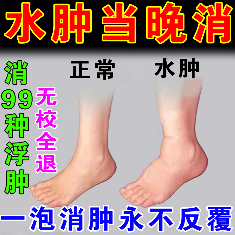 特效消水肿药利尿排水肿成人老人快速消脸部肿腿肿去下肢水肿神器