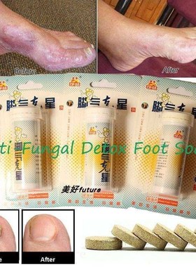 Foot Soak Cuticle Remover Skin Cracking,Psoriasis,Beriberi