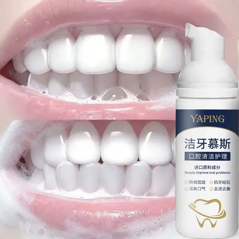 YAPING雅屏洁牙慕斯口腔清洁护理去黑垢牙黄牙渍烟渍结石清新口气