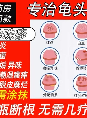 男性生殖器尖锐湿疣重组人干扰素α2ab凝胶10g抗病毒hpv尤靖安LX