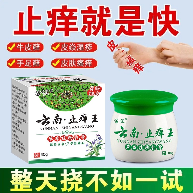 云南止痒王顽固性皮肤瘙痒快速止痒抑菌全身痒过敏外用牛皮藓药膏