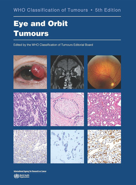 【新书】预订 眼和眼眶肿瘤 WHO肿瘤分类 第5版 Eye and Orbit Tumours: WHO Classification of Tumours 9789283245469