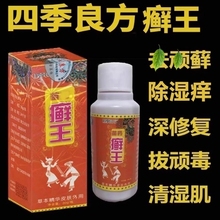 苗药癣王顽固牛皮藓根去药水银屑病杀菌止痒老牌子皮肤红肿起干皮