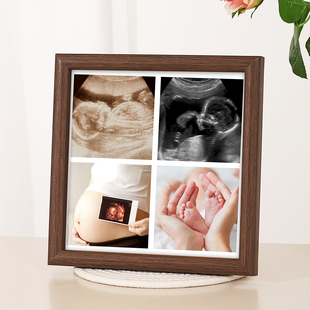 四维照片相框四维彩超相框宝宝四维纪念相框宝宝四维nt相框b超