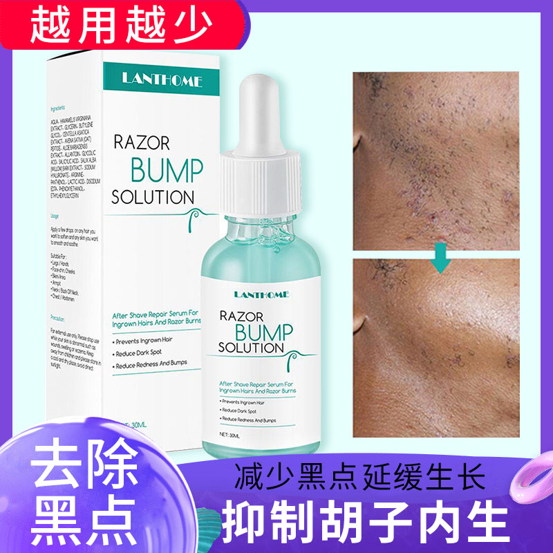 毛发抑制液温和去除黑点男士