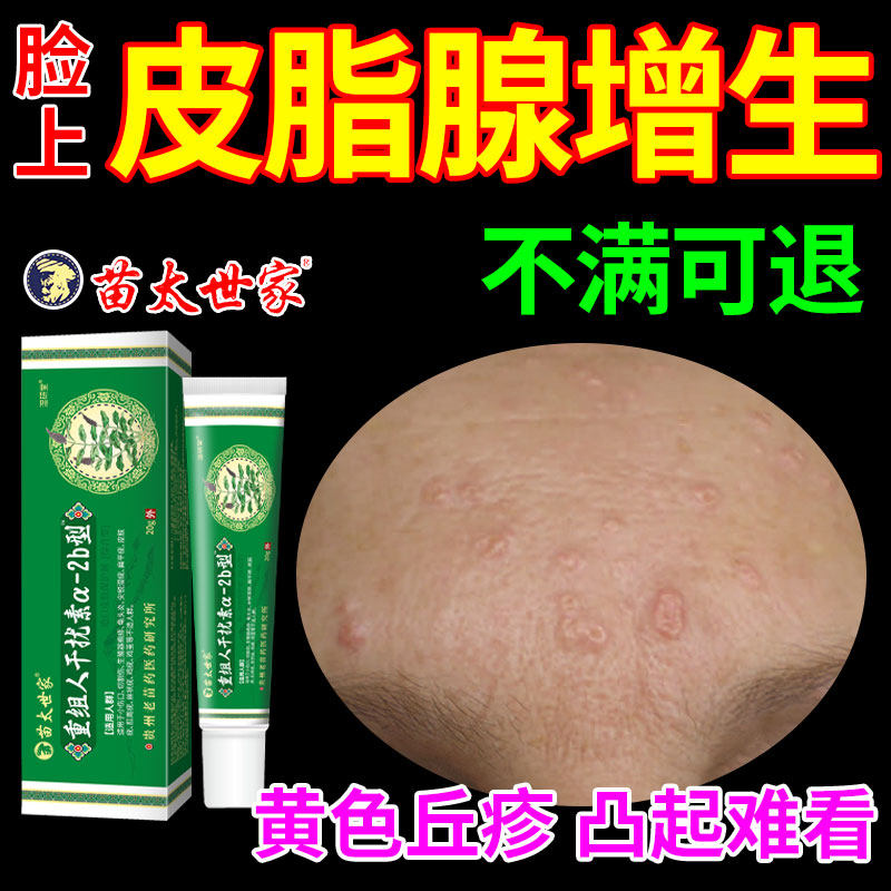 老年性脸上面部皮脂腺增生增大囊肿黄色丘疹粒小疙瘩qk