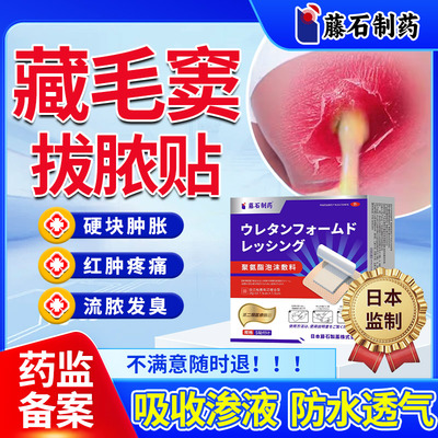 藏毛窦脓肿骶骨尾硬疙瘩拔脓贴