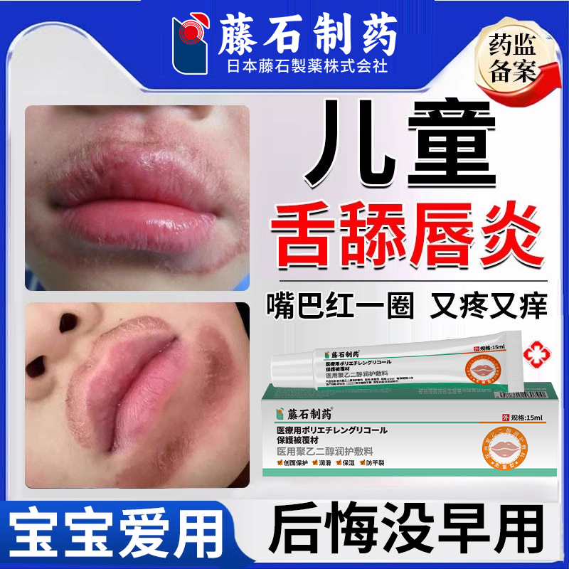 儿童唇炎口唇炎专用唇膏烂嘴巴