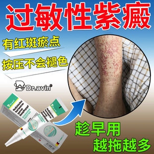 过敏性紫癜药房同售膏QK