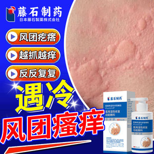 寒冷性寻荨麻疹过敏止痒断风团疙瘩瘙痒根沐浴露药房同售过敏性QK
