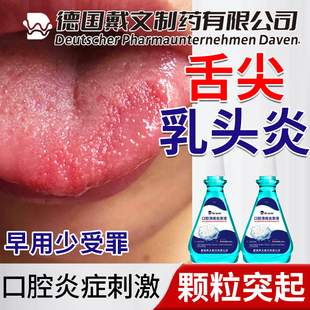 舌乳头炎舌头上火舌尖长疙瘩颗粒增生红点疼痛溃疡裂舌炎漱口水SK