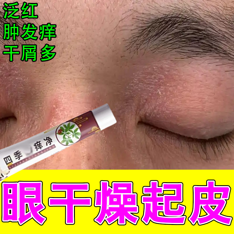 冶眼皮红肿干燥痒眼周过敏发痒眼角痒疼起皮掉屑眼皮痒保湿软膏