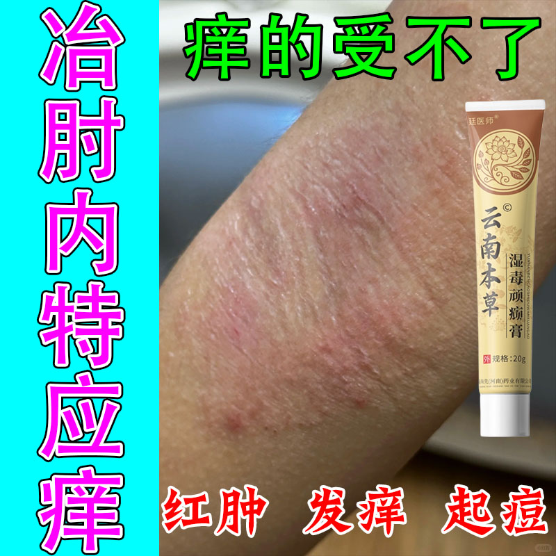 身上特应性发痒肘窝痒胳膊肘起水泡疙瘩红点皮肤过敏修护软膏