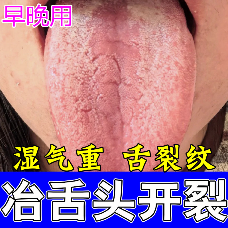舌头裂纹有齿痕舌苔腻口臭口干苦调理脾肝火旺盛修护植物喷剂