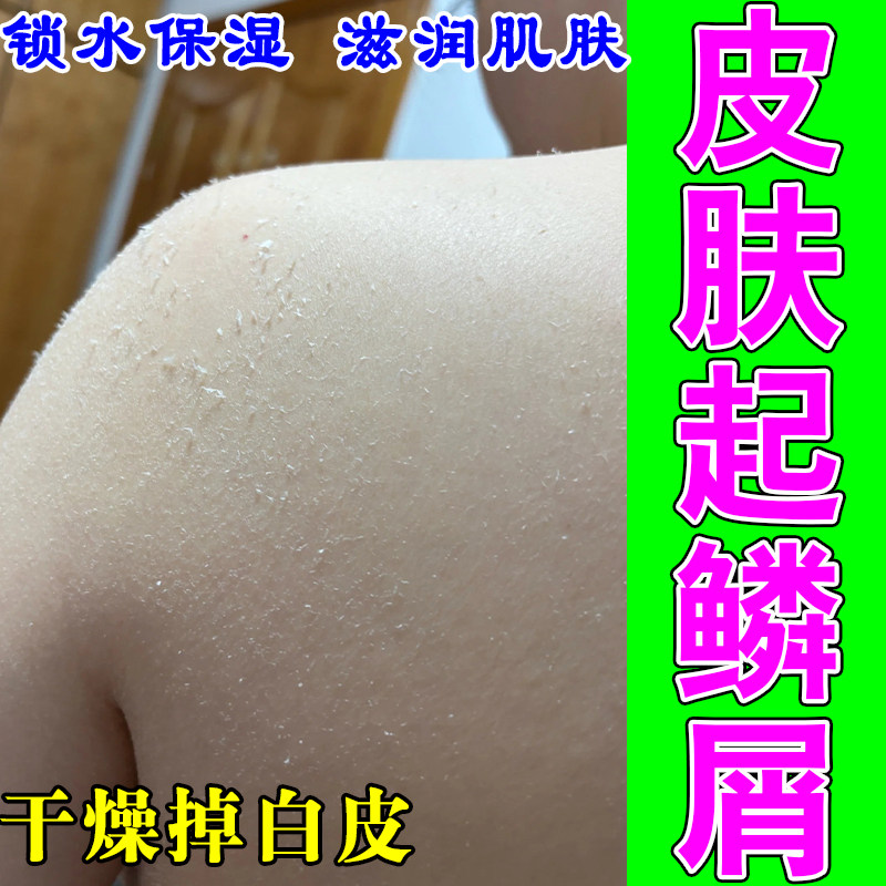 身上皮肤干燥起皮掉皮腿部皮肤干燥粗糙补水保湿修复润肤甘油