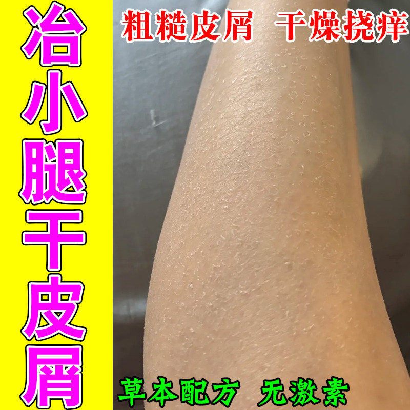 全身皮肤干燥起皮保补水胳膊腿上掉皮爆皮起屑皮身体保湿甘油