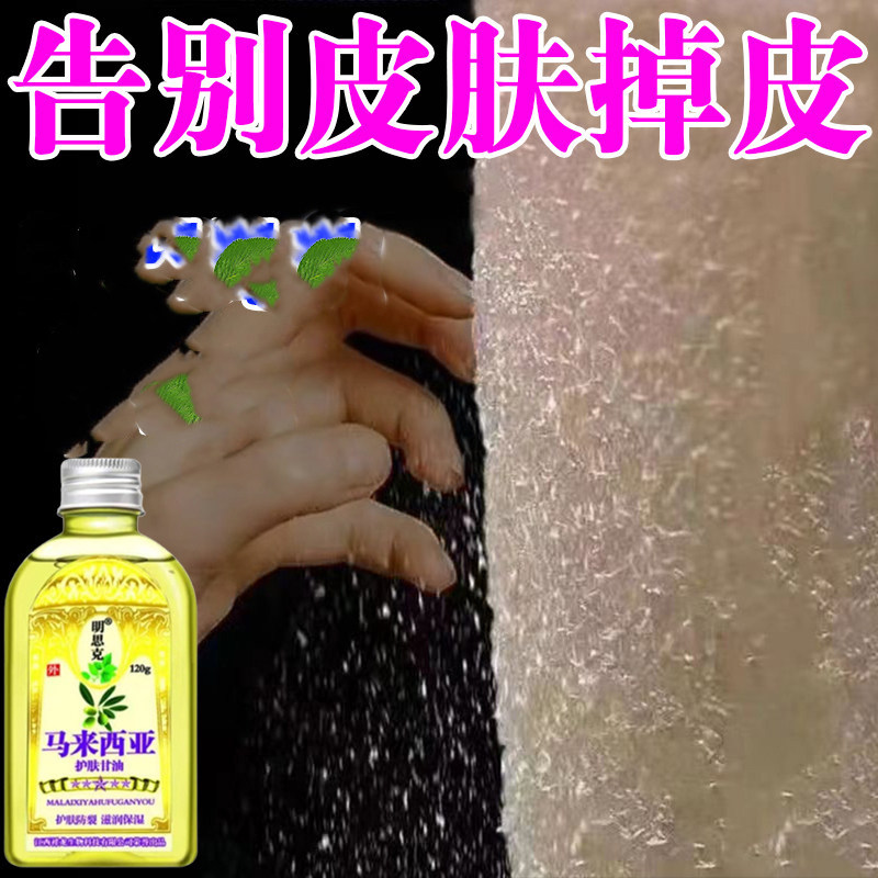 皮肤干燥保湿补水去小腿全身脱皮起皮掉皮病屑去干皮身体乳