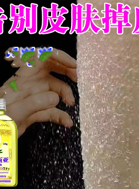 皮肤干燥保湿补水去鱼鳞皮小腿全身脱皮起皮掉皮病屑去干皮身体乳
