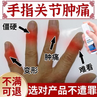 手指赫伯登结节专用膏药贴无菌性骨关节炎疼痛消肿薬房同款膏BS