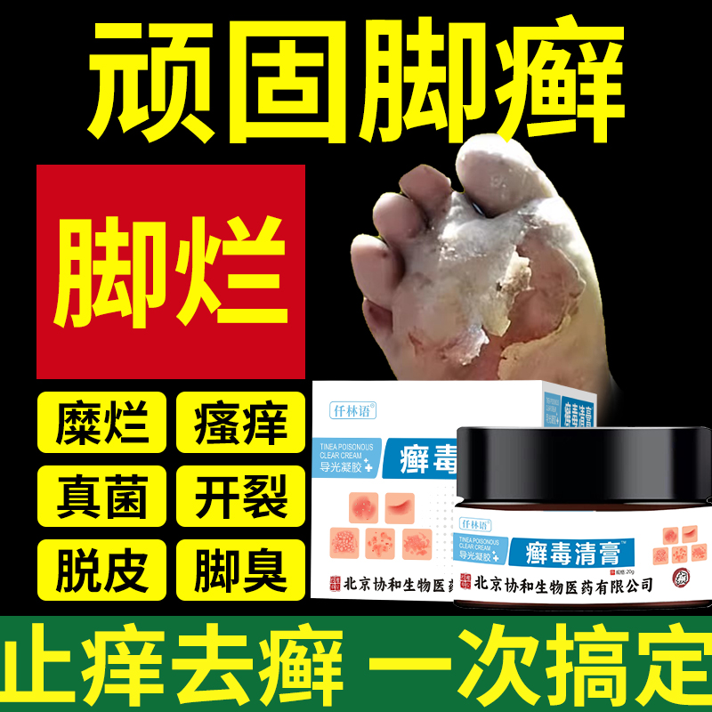 足癣脚癣一次净特效足藓脚藓药膏脚气真菌感染止痒去根治烂脚丫JK
