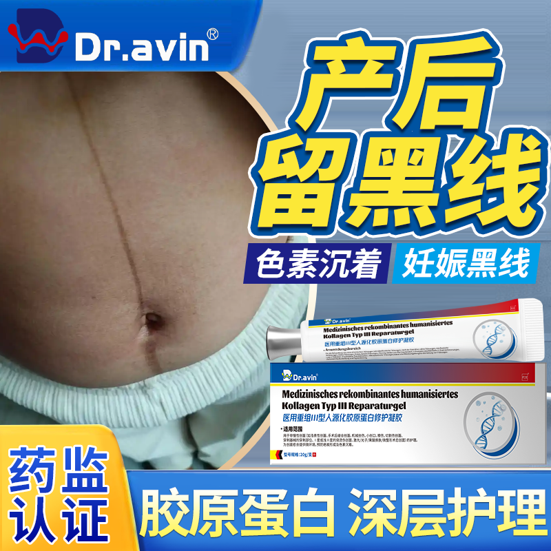 产后肚子黑色素沉淀去黑线妊娠线消除黑怎么办胶原蛋白修复凝胶OZ