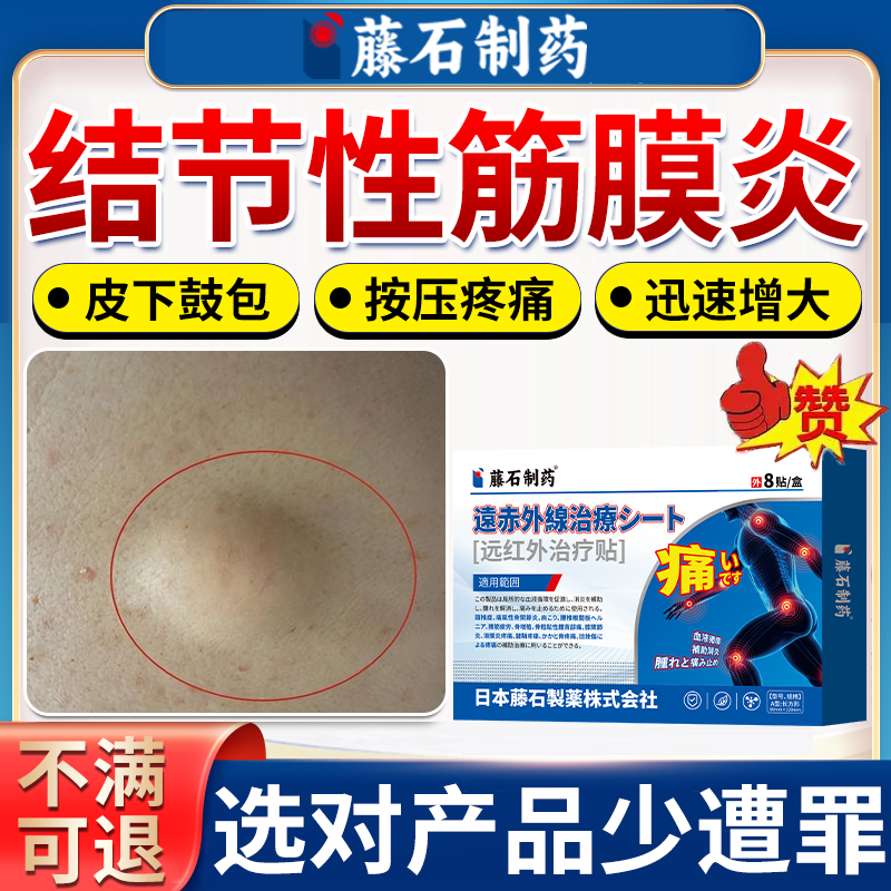 皮下鼓包疼痛结节性筋膜炎散结贴