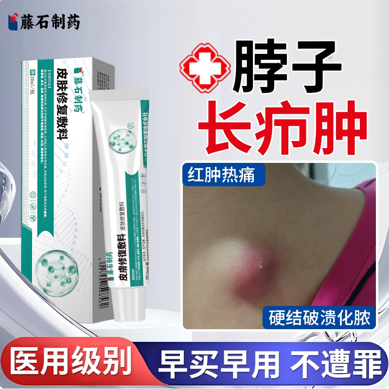 【医用级】脖子颈部长疖肿火疖子图片