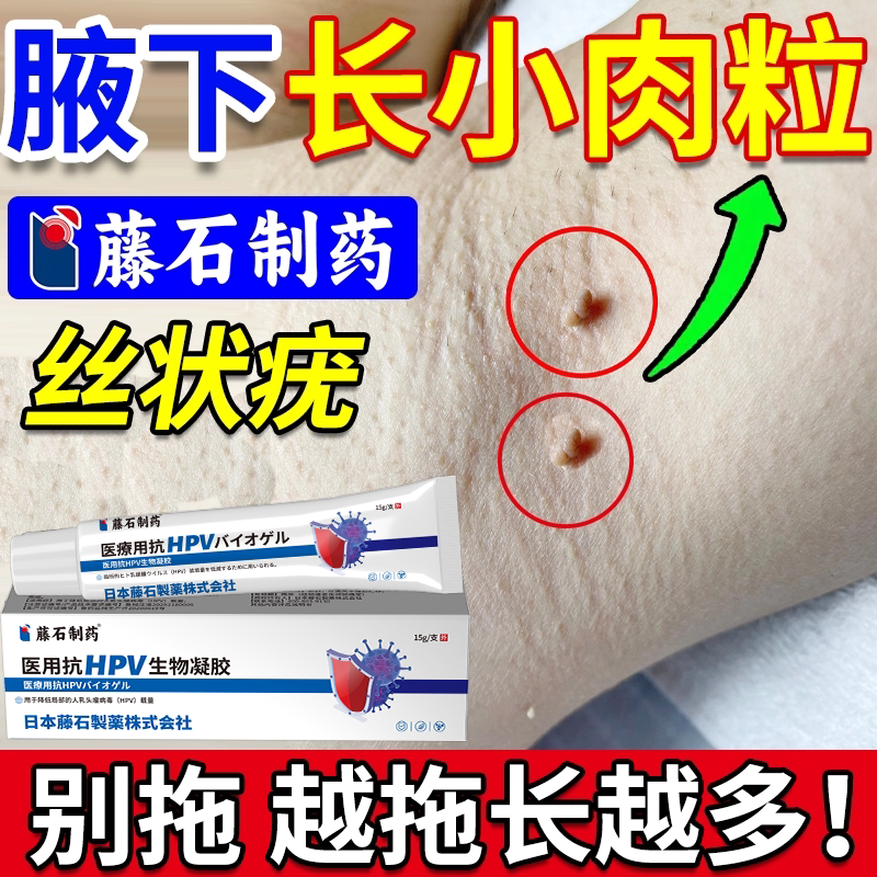 藤石制药腋窝胳肢窝丝状疣腋下小肉粒去除再合成皮赘去疣膏神器jw