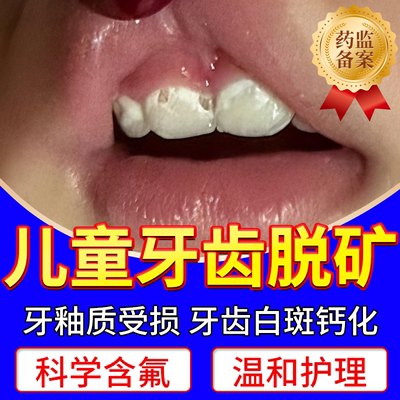 【医用级】儿童牙齿脱矿再矿化膏