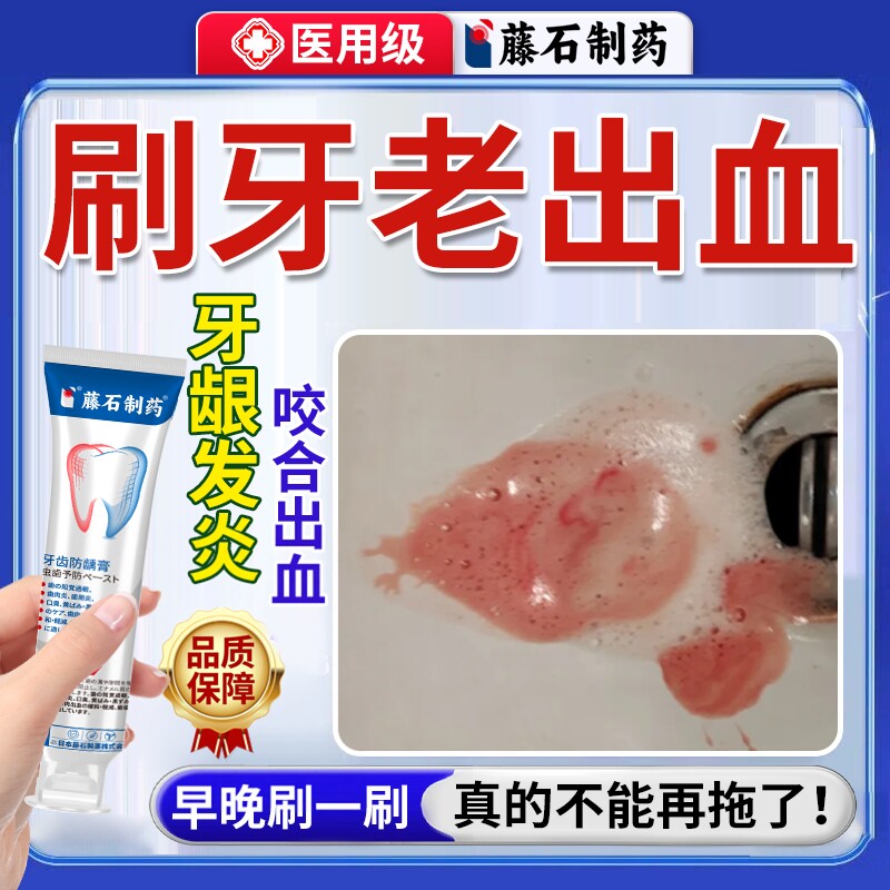 治疗防牙龈出血专用的牙膏脱敏剂止血护龈牙齿用什么牙周炎口臭OZ