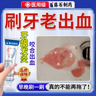 治疗防牙龈出血专用的牙膏脱敏剂止血护龈牙齿用什么牙周炎口臭OZ