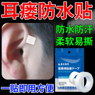 耳前瘘管防水贴搭耳瘘管耳瘘清理工具防感染医用压敏胶带可手撕DZ