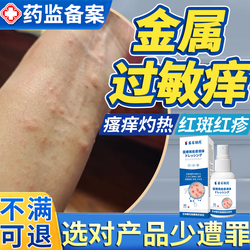 针对皮肤金属过敏【不满可退】