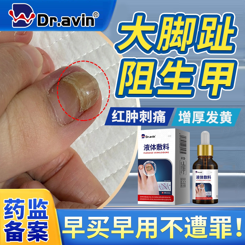 【医用级】大脚拇指阻生甲修复液图片